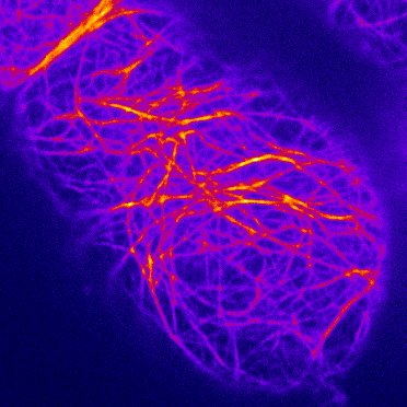 総説論文がオンライン公開されました。