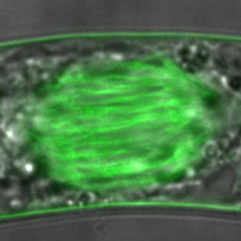 総説論文が掲載されました。