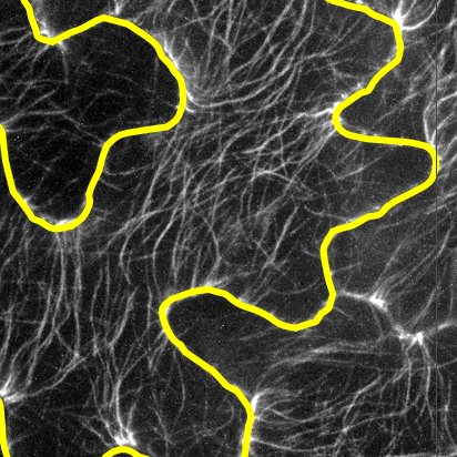 第31回日本バイオイメージング学会学術集会で発表しました。