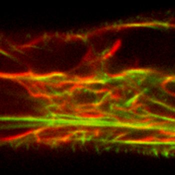 金沢大学との総説論文が掲載されました。