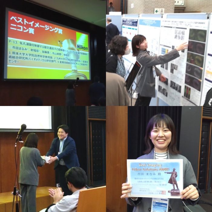 市田さんが日本バイオイメージング学会で受賞しました。