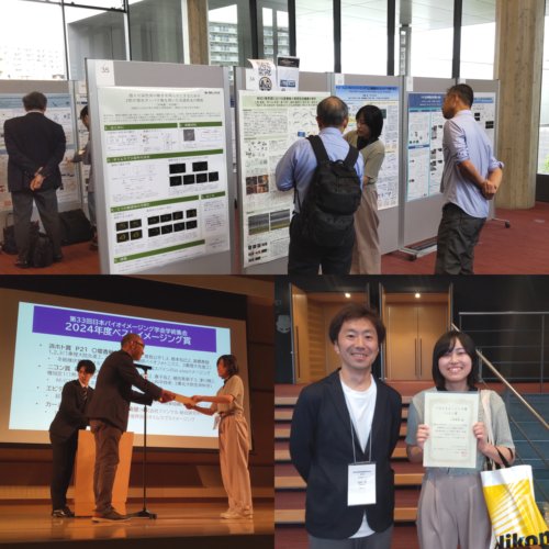 小野さんが日本バイオイメージング学会で受賞しました。