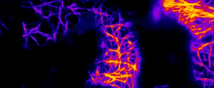 千葉大学らとの共同研究が論文として掲載されました。